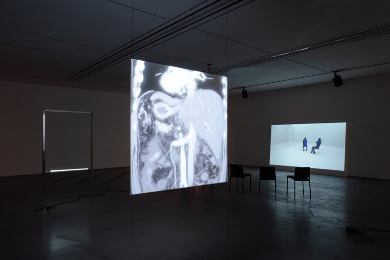 Installation view