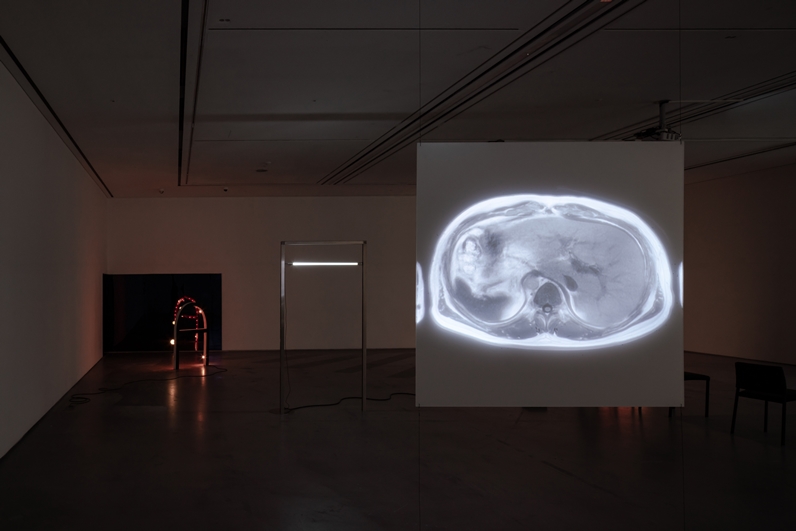 Installation view